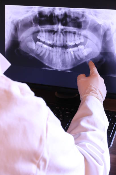 Teeth Whitening in SC